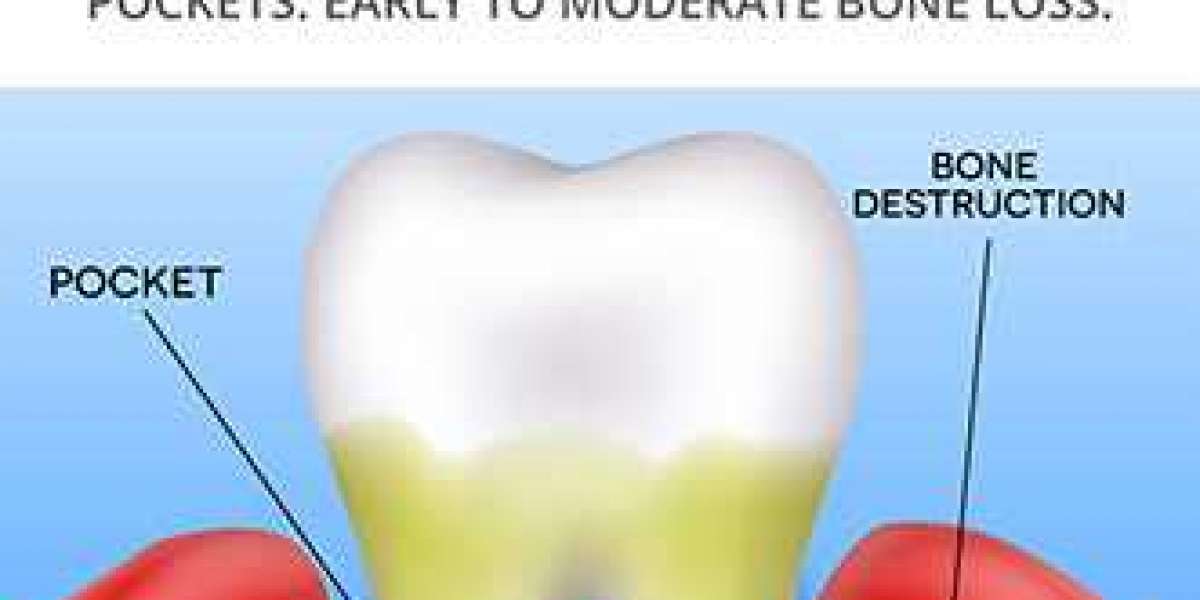 Simple Steps to Fighting Gum Disease Naturally