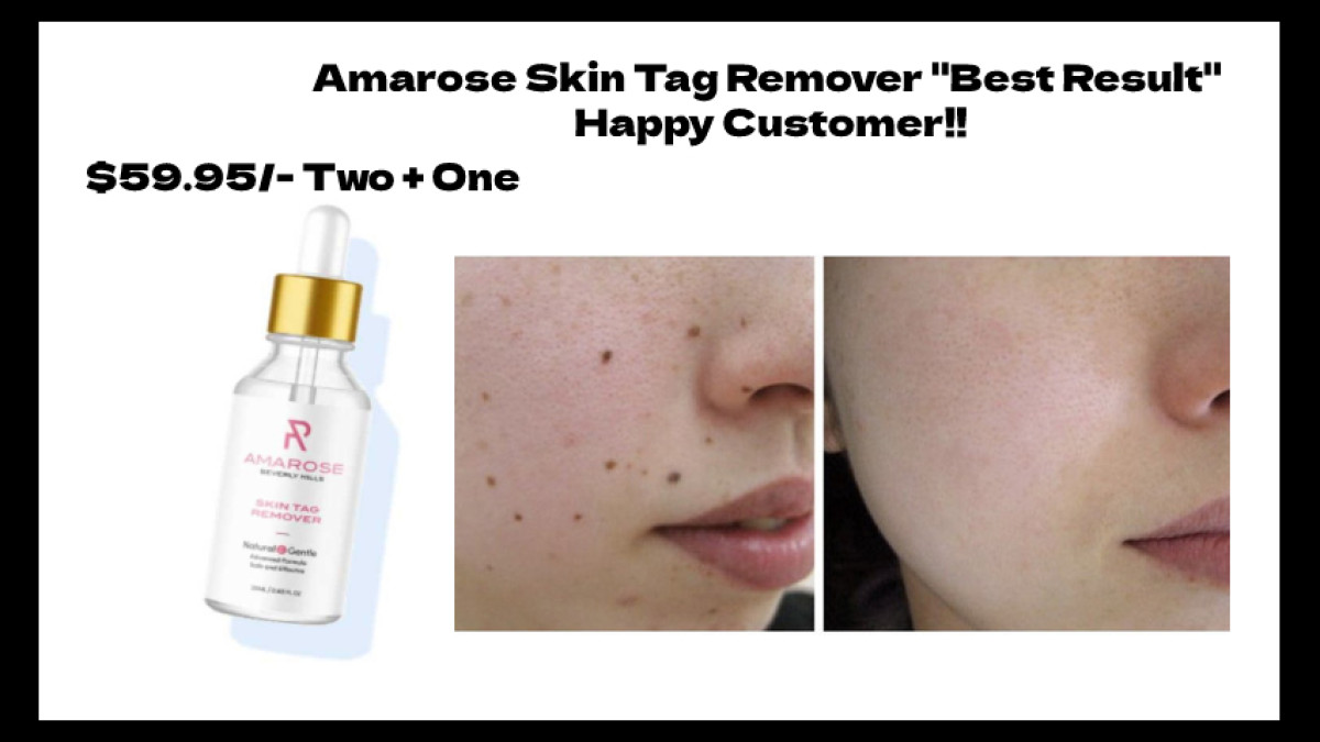 [REPORT 2022] 'Amarose Skin Tag Remover Reviews': (SHOCKING FACTS) Does “Amarose” Worth $69.95 Cost in USA?