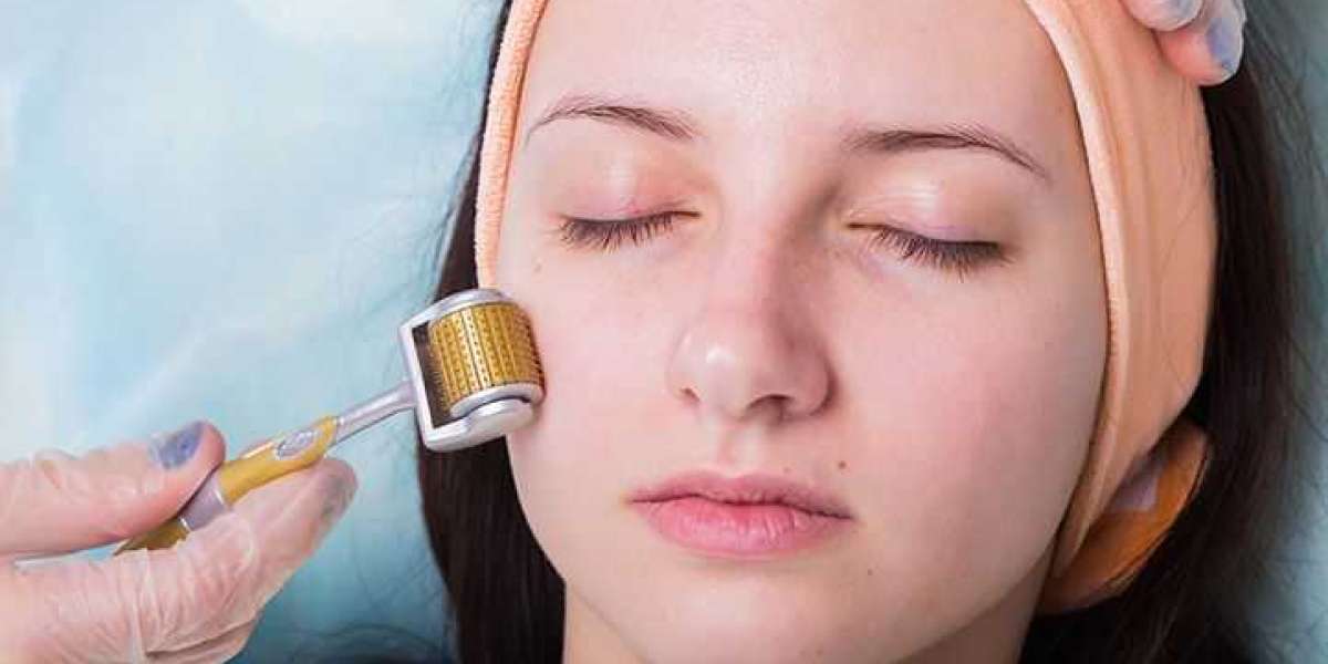 What Is Microneedling, And Why Should You Do It?