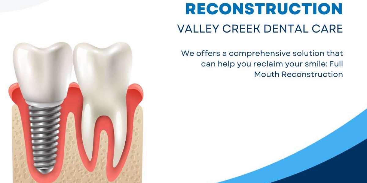 Discover Dental Implants Near You in McKinney, TX