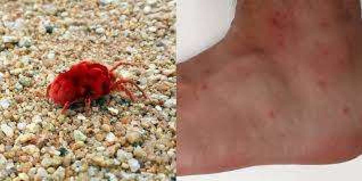 How to Get Rid of Chiggers: Tips for Relieving the Itch