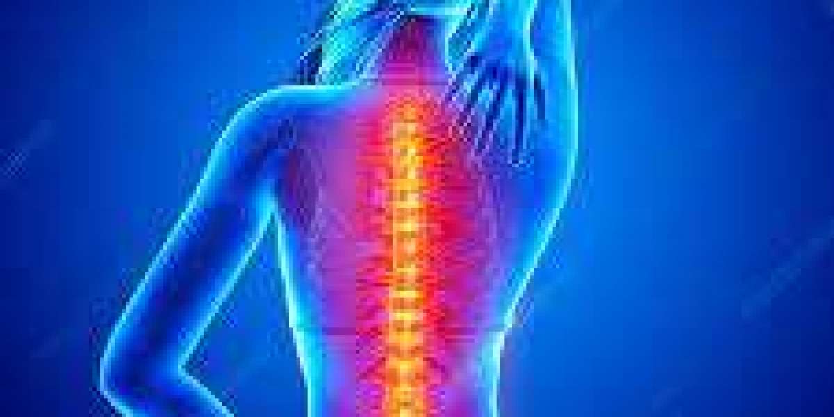 Effective Strategies to Alleviate Severe Back Pain