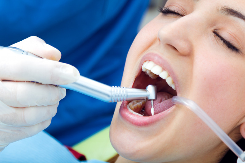 Best Teeth Fillings Service Doctors In Faridabad: ext_6482872 — LiveJournal